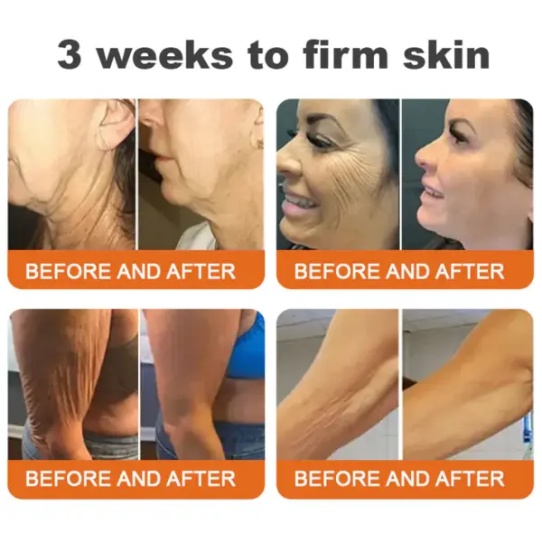 Fabricado e enviado dos EUA ✨TLOPA® Botox Bee Venom Firming Serum Stick (🔥ÚLTIMO DIA COM 70% DE DESCONTO)💄 - Imagem 5